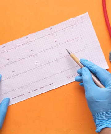 ECG