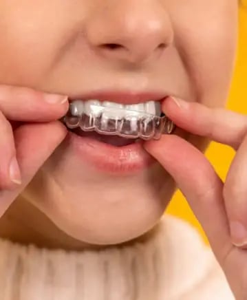 Dental Checkups