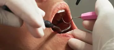 Dental Checkup